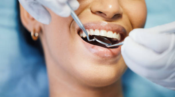 Best Emergency Denture Repair in Barrackville, WV