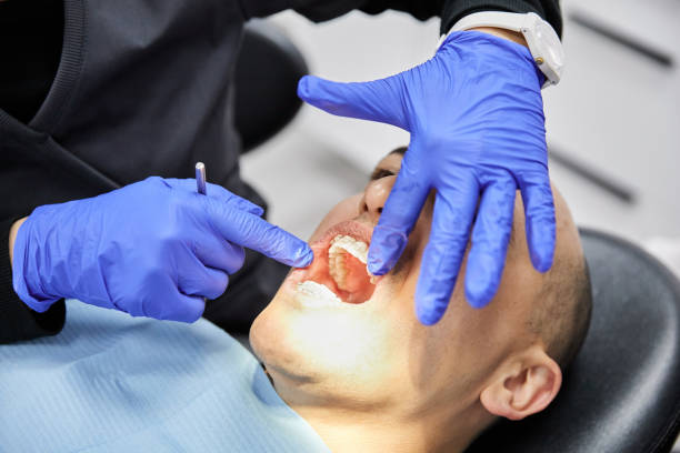 Best Emergency Wisdom Tooth Extraction in Barrackville, WV